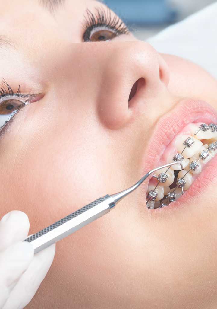 Loosening of Teeth